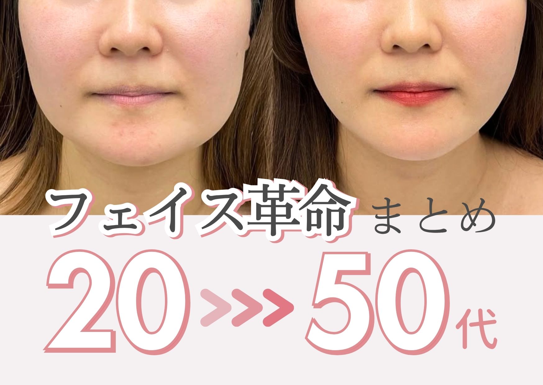【小顔 症例集】新潟で小顔になるなら出口医師におまかせ｜脂肪吸引・脂肪注入・糸リフト